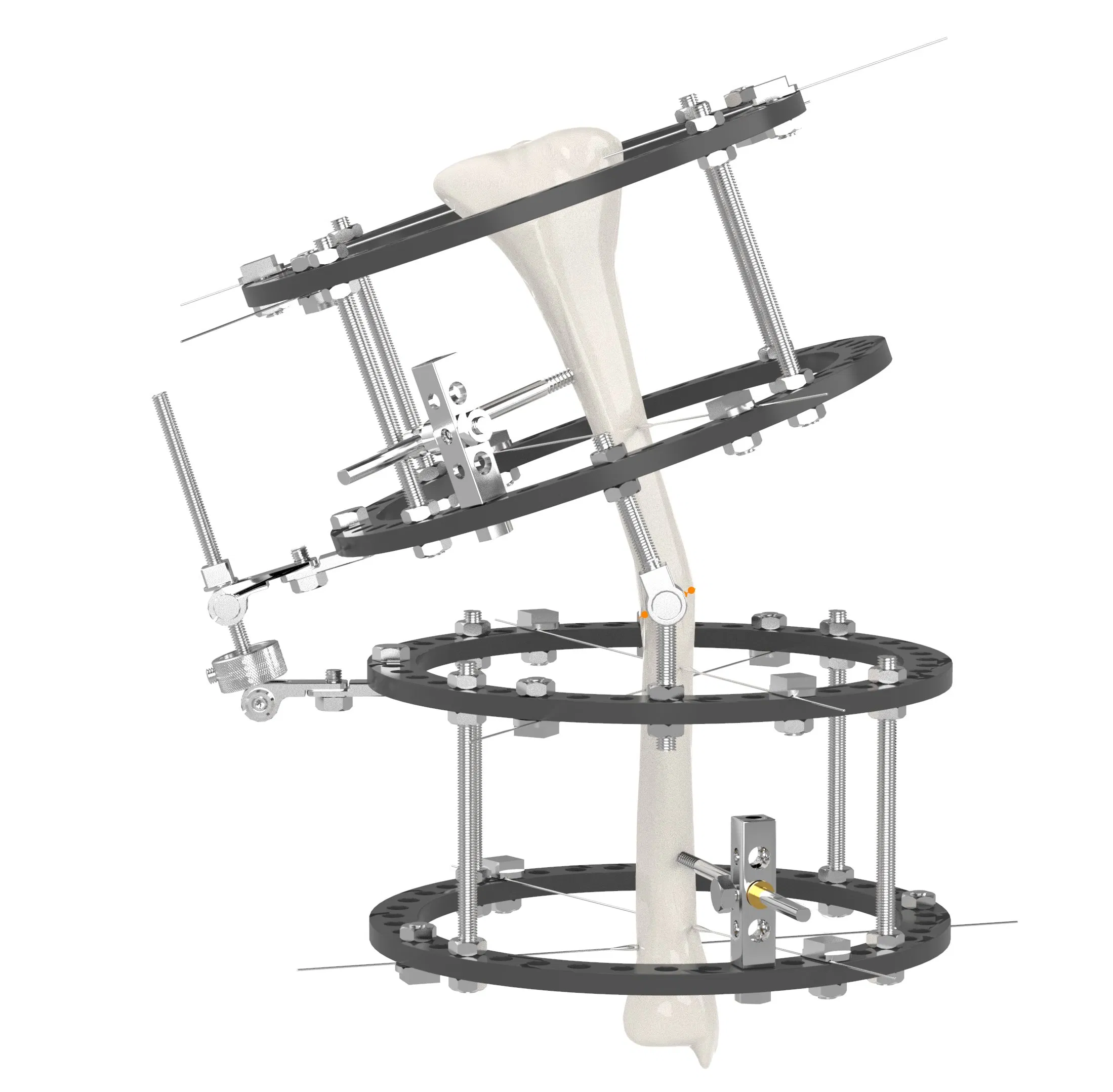Canwell Small Bones Fracture Fixation Mini External Fixator Orthopedic Trauma Implant System for Phalanges and Metacarpals