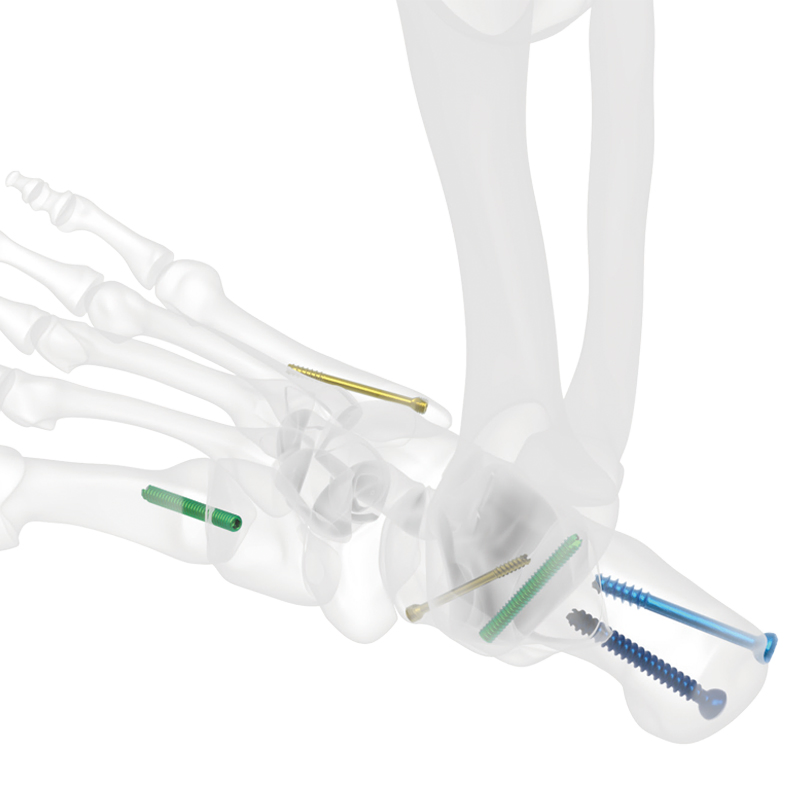 Medical Orthopedic Implant Versatile Ball-Headed Cannulated Screws