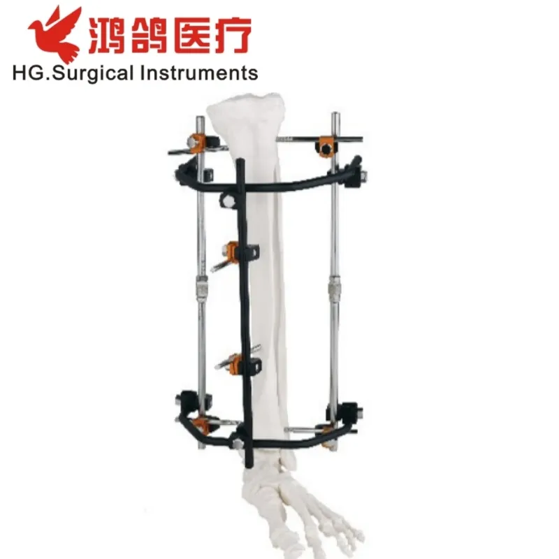 Orthopedic External Fixator 1