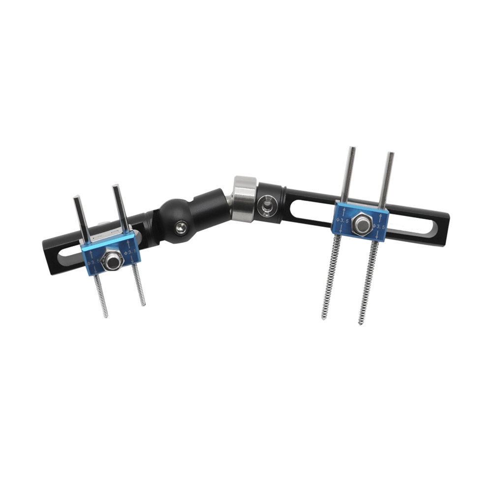 Factory Price Orthopedic Surgical Instruments Wrist Joints External Fixator for Fracture Surgery