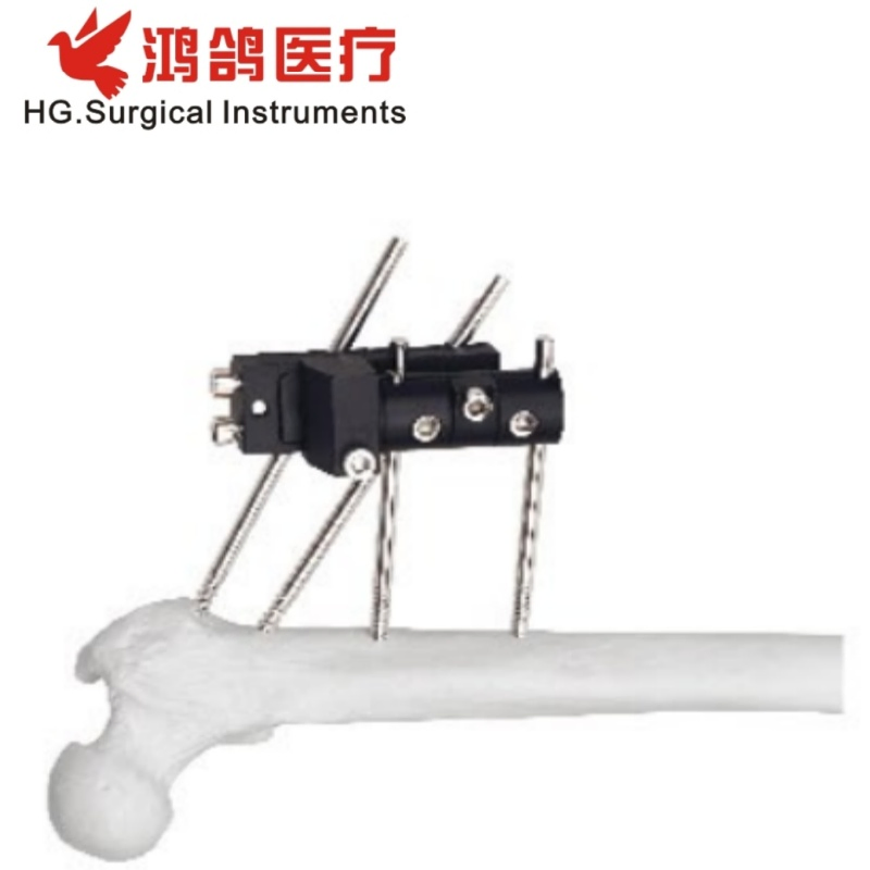 Orthopedic Instrument Dynamic Axial External Fixator Medical Supply Hospital Equipment