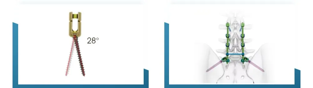 Product Features Angle