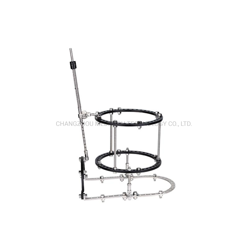 Ilizarov Ring External Fixator Orthopedic Instruments Ankle Joint External Fixator