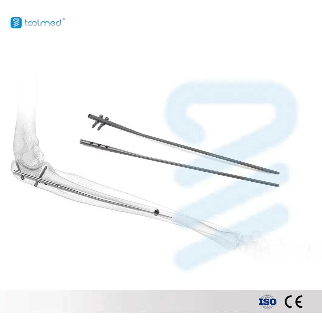 Elastic Intramedullary Nail 1