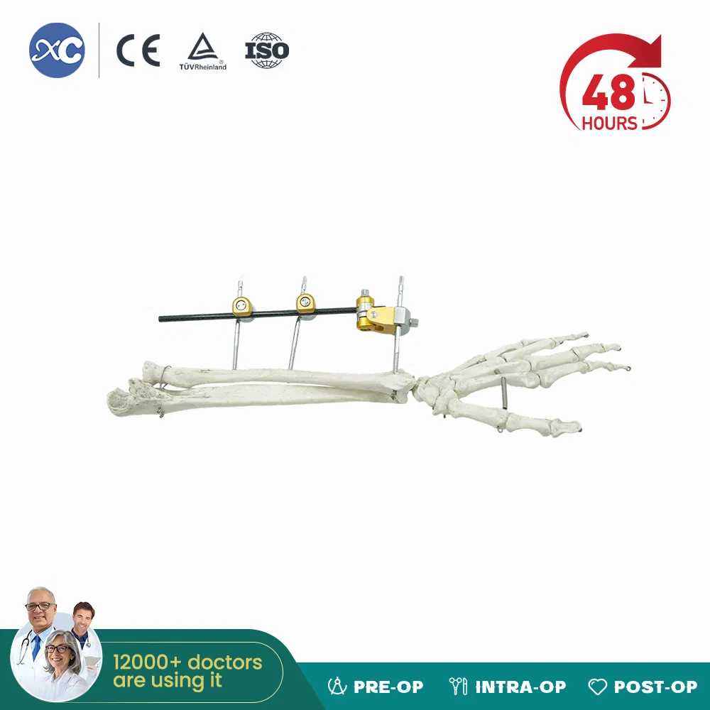 Elbow External Fixator Medium Tubular Bones Fracture Fixation Elbow Hinge Fixator