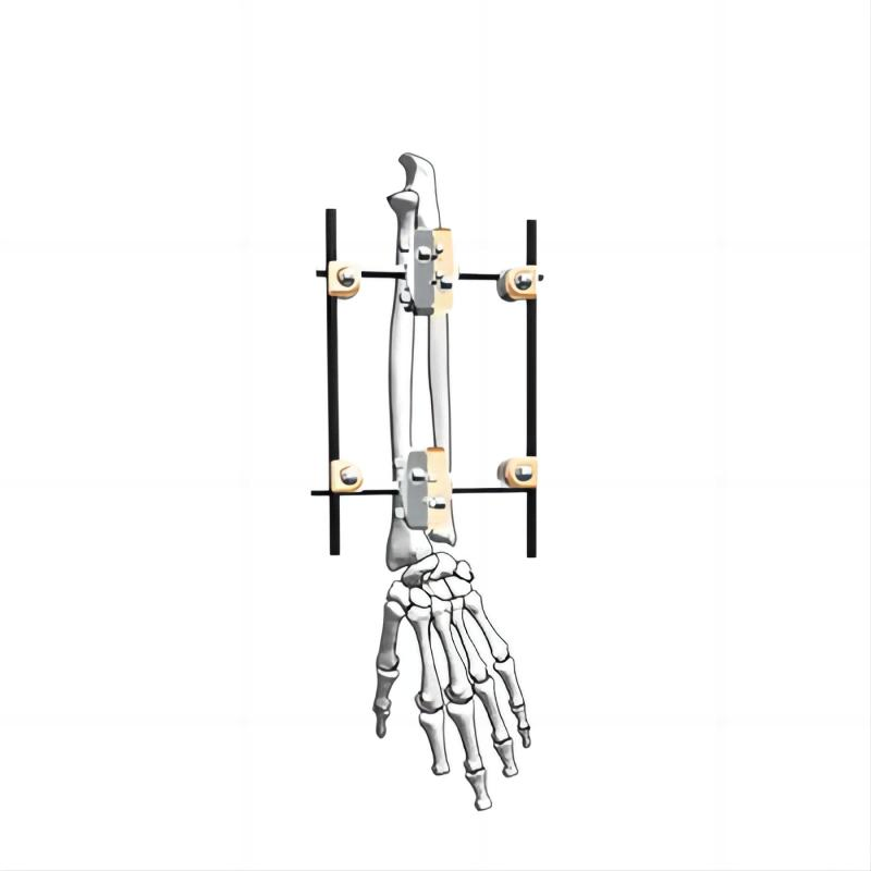 Orthopedic External Fixation System Radius External Fixator 5mm