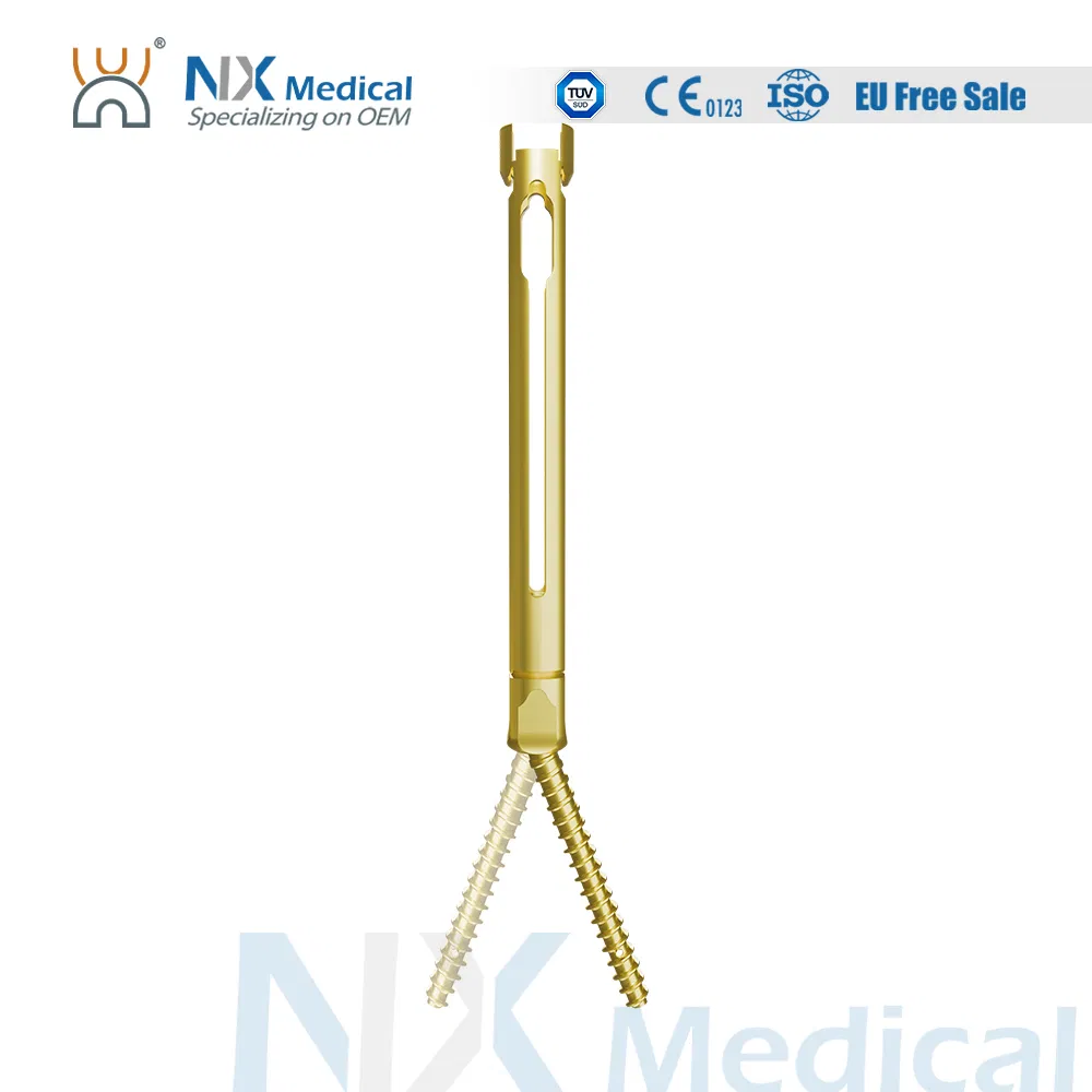 Nx Medical Titanium Cannulated Bone Cement Pedicle Screw 5.5mm Orthopedic Internal Fixation