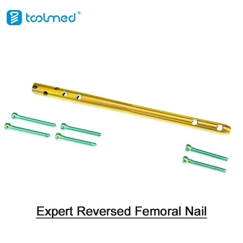 Trauma Expert-Level Nail