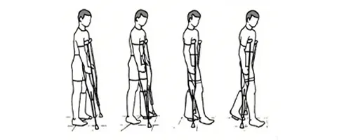 Early Weight-Bearing