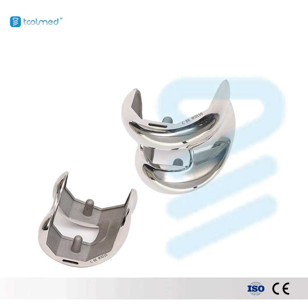 Orthopedic Knee Prosthesis Detail