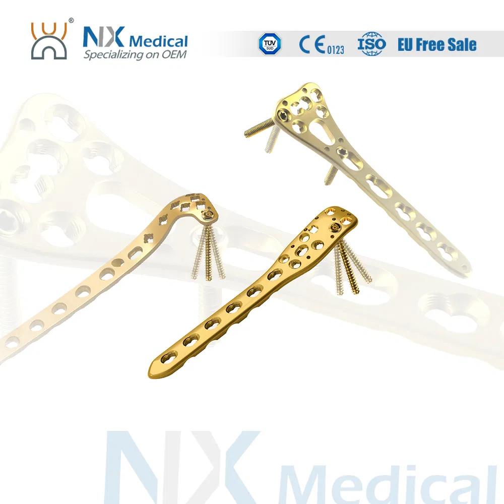 Nx Medical Orthopedic Variable Angle Locking Plate LCP for Distal Femur Fixation