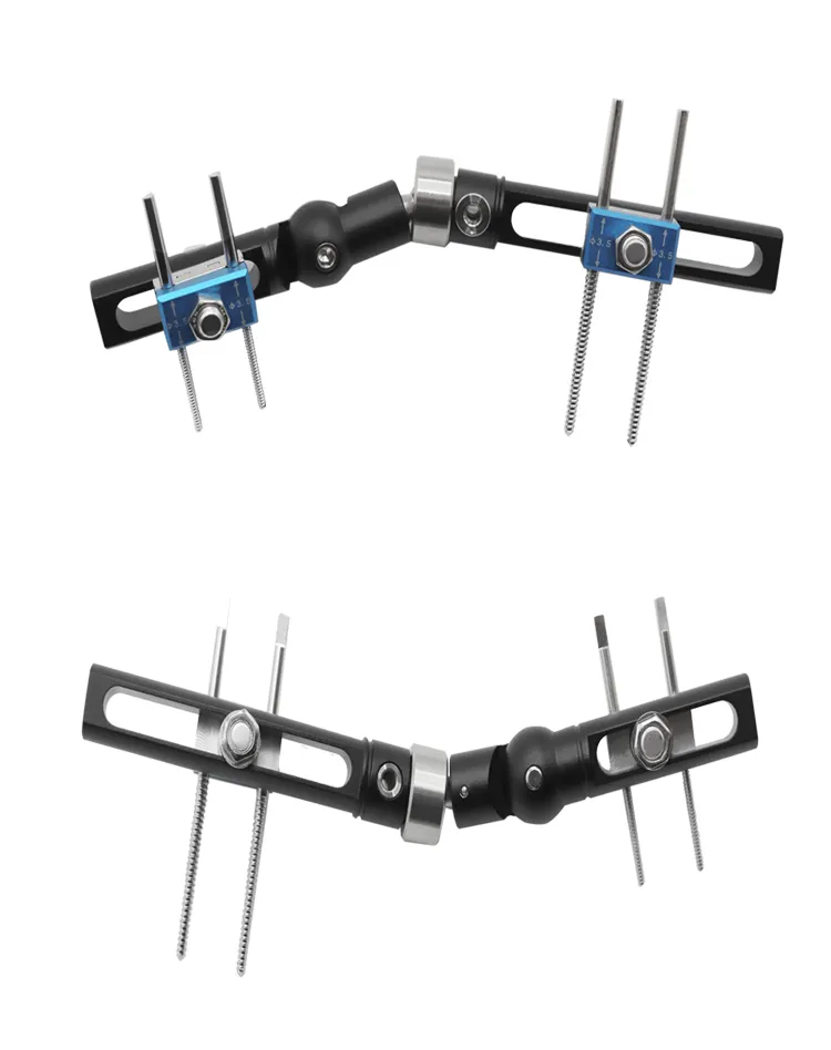 Wrist Joints External Fixator 6