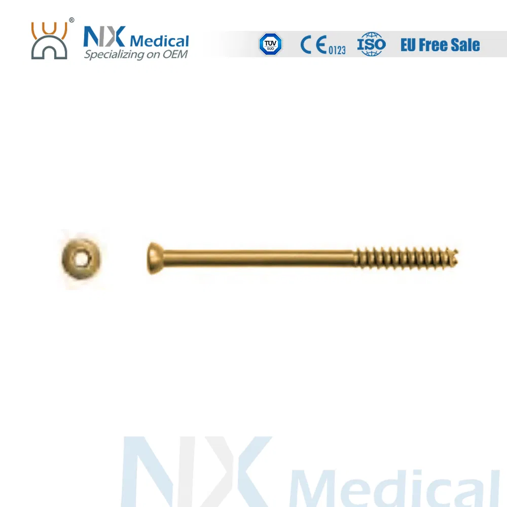 Nx Medical Orthopedic Trauma Implant Cannulated Screw for Bone Fixation