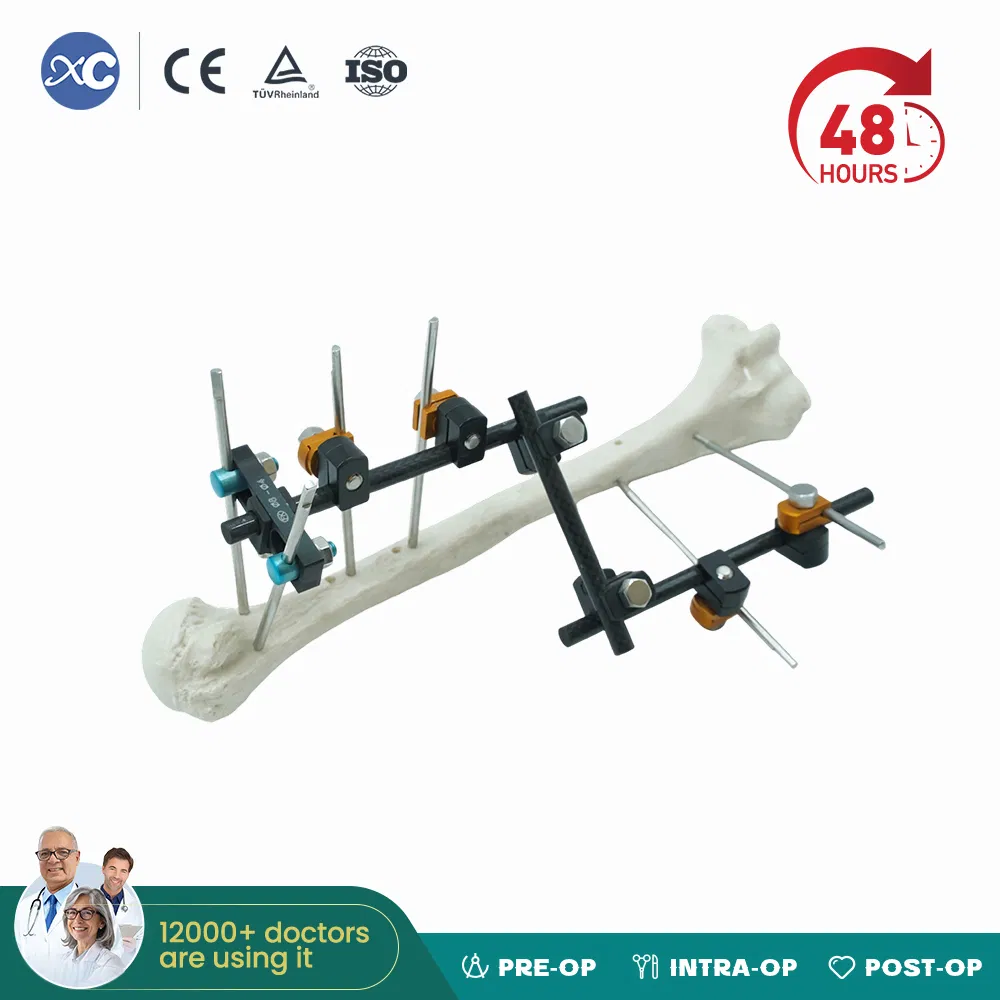 Elbow External Fixator Medium Tubular Bones Fracture Fixation Elbow Hinge Fixator