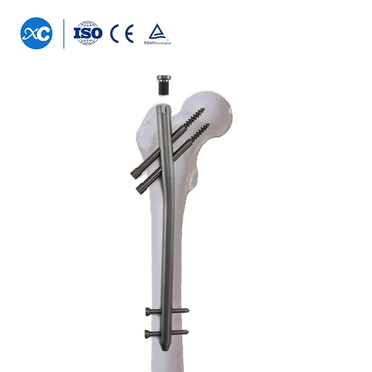 Factory Price Titaniuam Orthopedic Implants Surgical Femoral Pfna Gamma Interlocking Intramedullary Nail