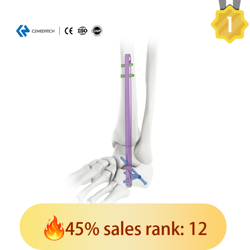 Hindfoot Fusion Ankle Intramedullary Nail Titanium Interlocking Nail Exporters Hospital Surgical Equipment