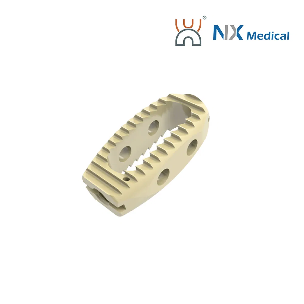 Nx Medical OEM/ODM Support Orthopedic Implant Available Lumbar Cage for Spinal Surgery