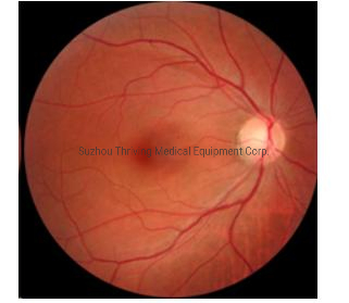Manufacturer Medical Non-Mydriatic Automatic Eye Fundus Camera Ophthalmic Equipment