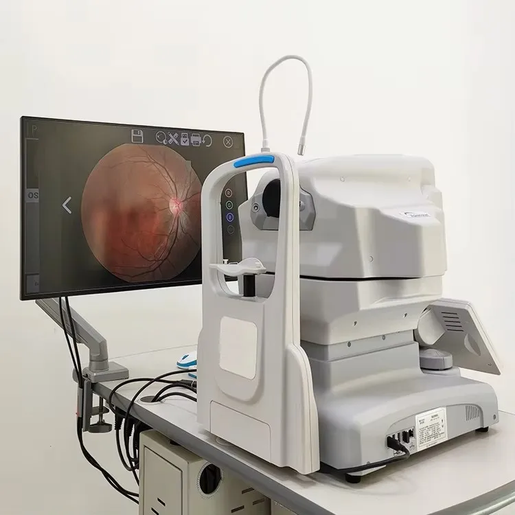 Fundus Camera View