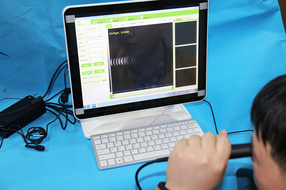 Ophthalmic Ultrasound a/B Scanner Ophthalmic Ultrasound Machine Ophthalmology Equipment Price