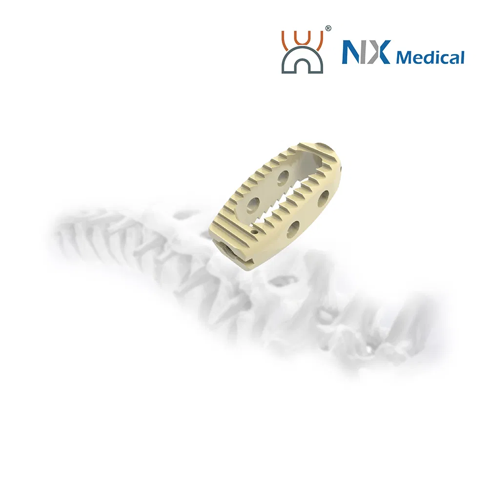 Nx Medical OEM/ODM Support Orthopedic Implant Available Lumbar Cage for Spinal Surgery