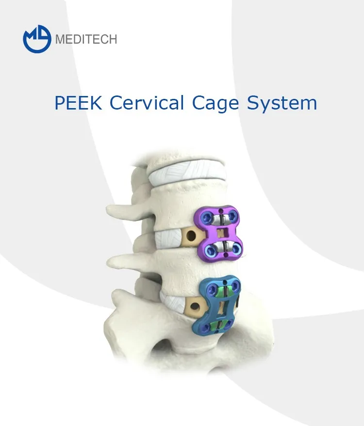 Cervical Peek Cage