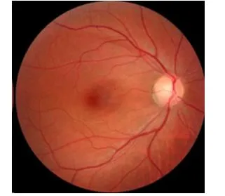 High Resolution Imaging