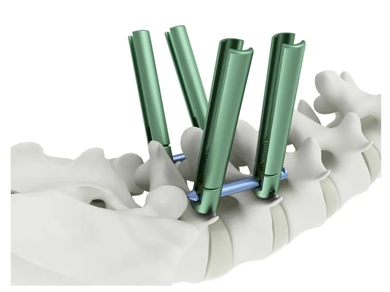 Cervical Pedicle Screw System