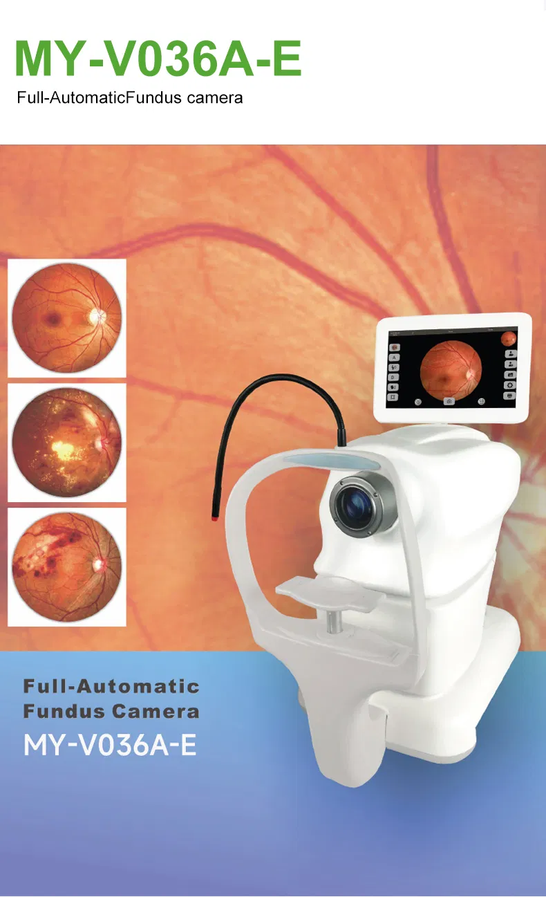 Fundus Camera View 5