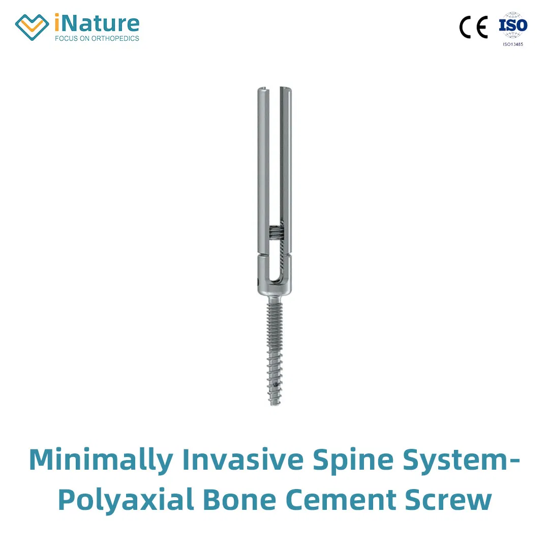 Top Quality Posterior Pedicle Screws Orthopedic Implants Titanium Material