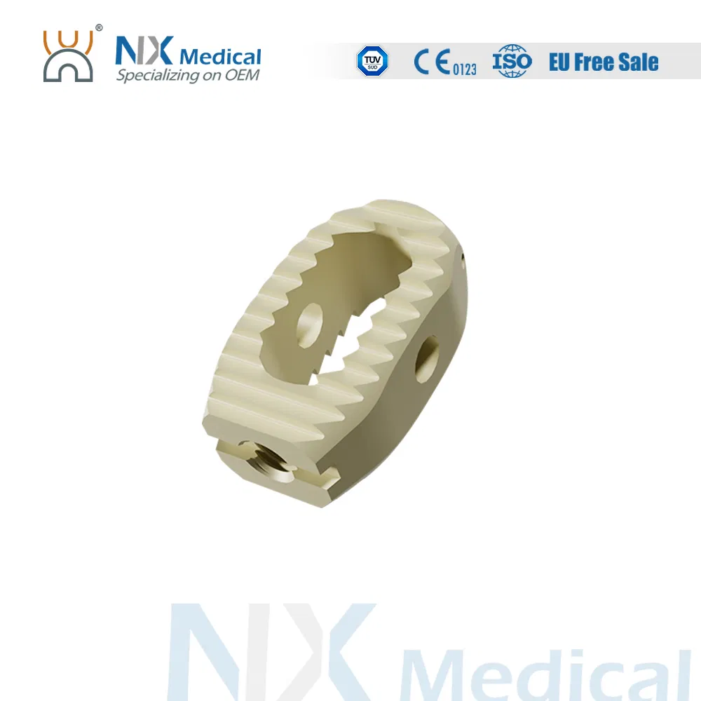 Nx Medical OEM/ODM Support Orthopedic Implant Available Lumbar Cage for Spinal Surgery