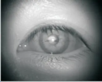 Small Pupil Capability