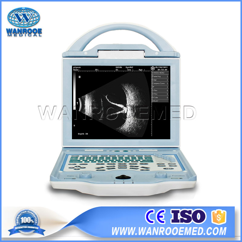 Us101 Hospital Portable Full Digital Ophthalmic a/B Ultrasound Scanner Biometer Equipment