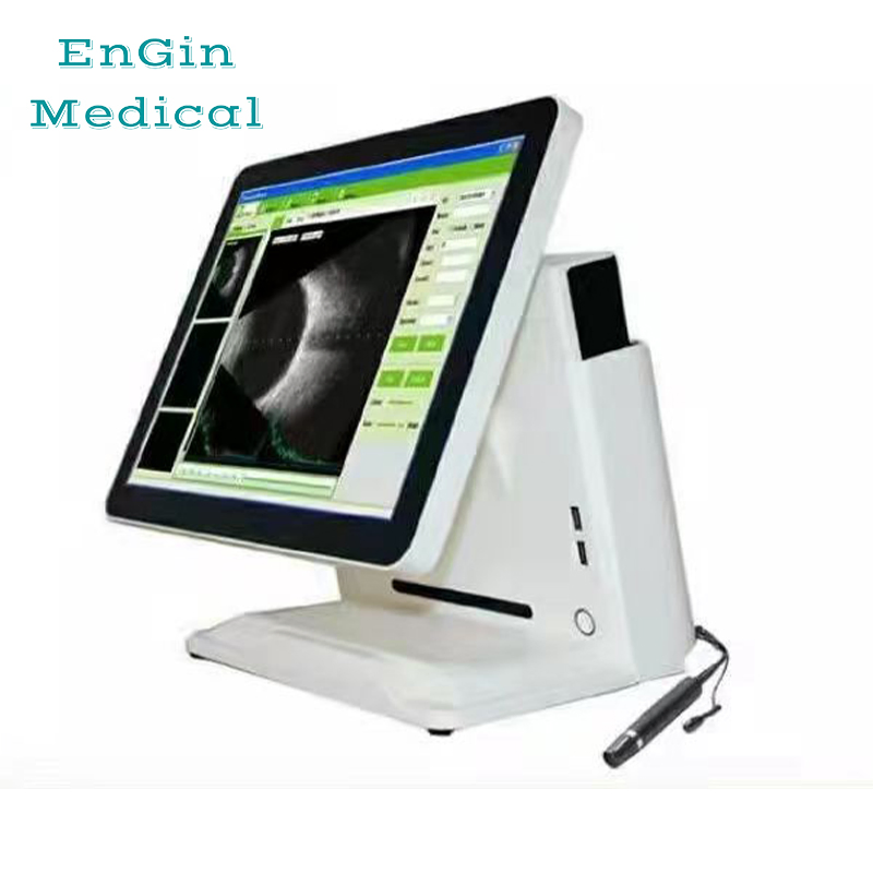 Easy Measurement and Operation Ab Scan Ophthalmic Ultrasound Equipment