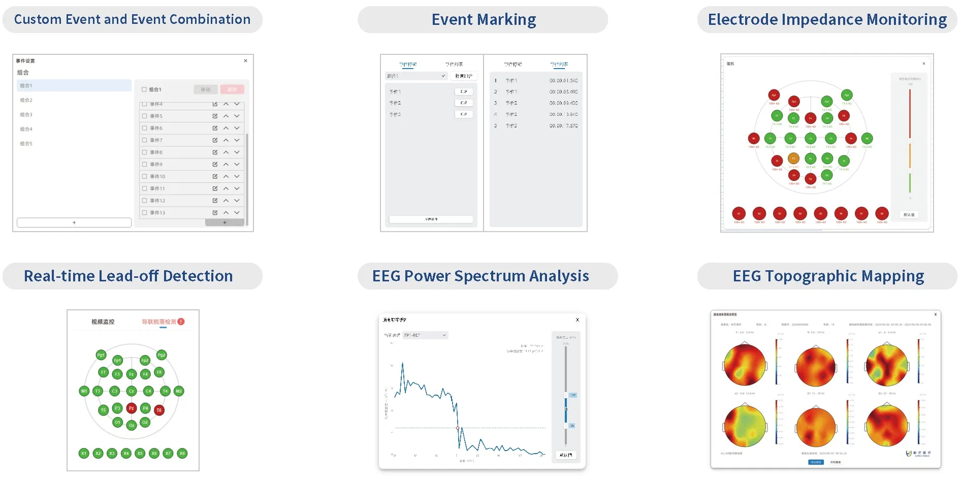 Medical EEG Machine Digital EEG Equipment Medical Instrument EEG System