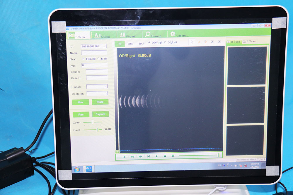 Ophthalmic Ultrasound a/B Scanner Ophthalmic Ultrasound Machine Ophthalmology Equipment Price