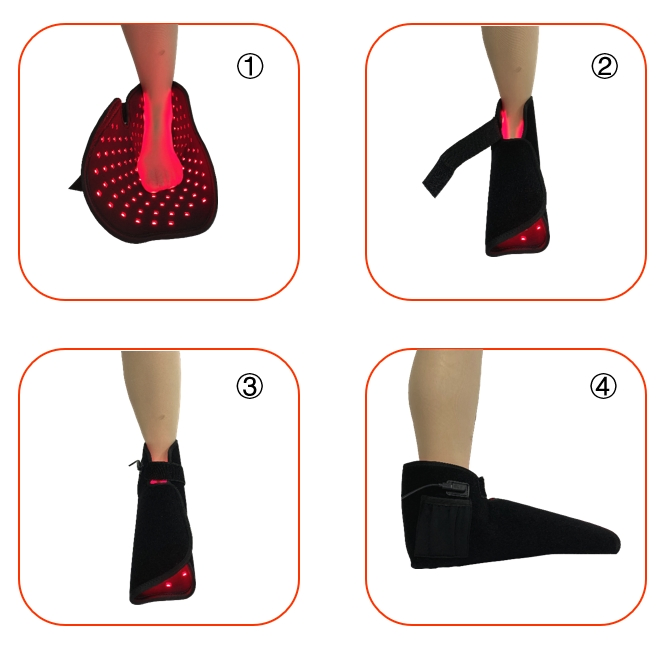 Soft and Portable 159PCS 3 in 1 Chip Red Light Near Infrared Light Simple Shoes