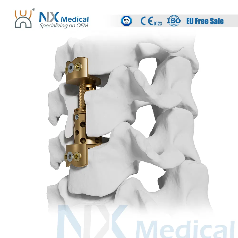 Nx Medical Expandable Cervical Cage Implant for Orthopedic Intervertebral Fixation Spine Vertebral Spacers