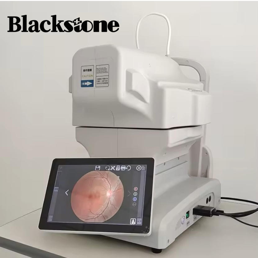 Ophthalmic Non-Mydriatic Automatic Digital Fundus Camera Ophthalmic Medical Equipment Customizable Options
