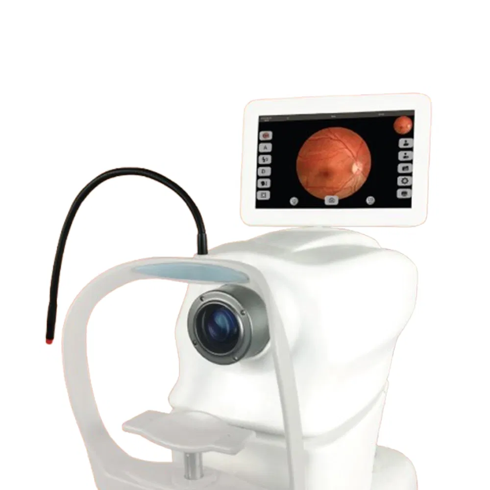 My-V036A-E Automatic Ophthalmic Retinal Fundus Camera Equipments