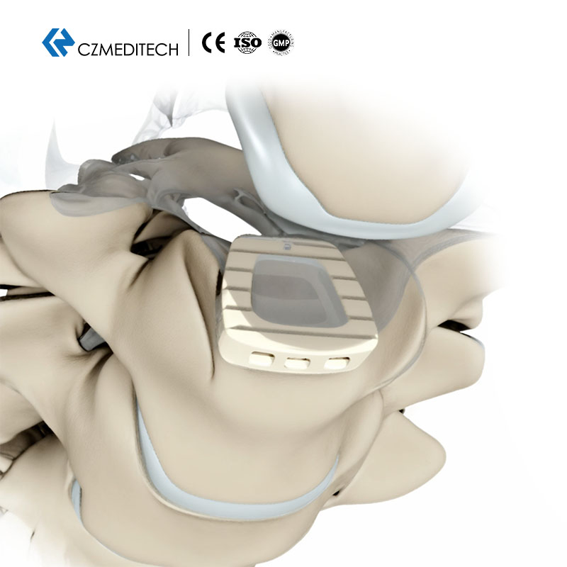 Cervical Peek Cage-Orthopedic Spinal Implant for Fusion Surgery