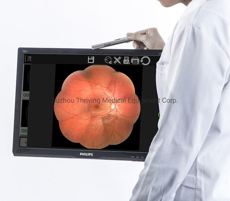 Manufacturer Medical Non-Mydriatic Automatic Eye Fundus Camera Ophthalmic Equipment