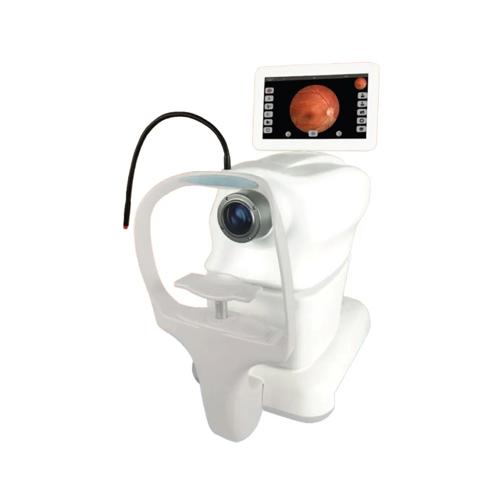 My-V036A-E Automatic Ophthalmic Retinal Fundus Camera Equipments