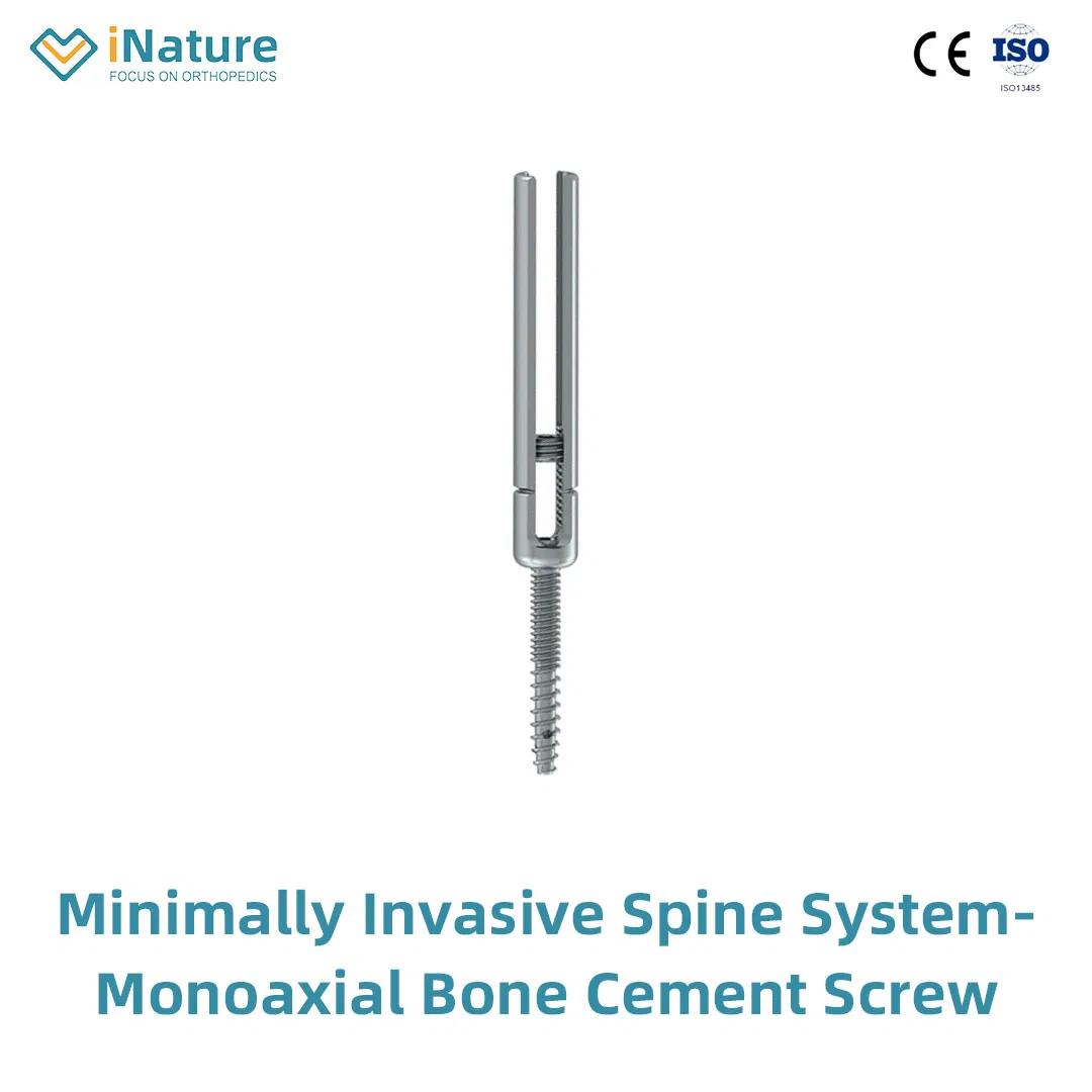 Top Quality Posterior Pedicle Screws Orthopedic Implants Titanium Material