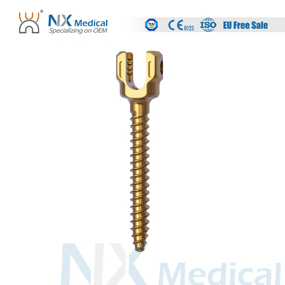 Nx Medical Orthopedic Implant Titanium Sf-III Spinal Pedicle Screw 5.5mm for Bone Fixation