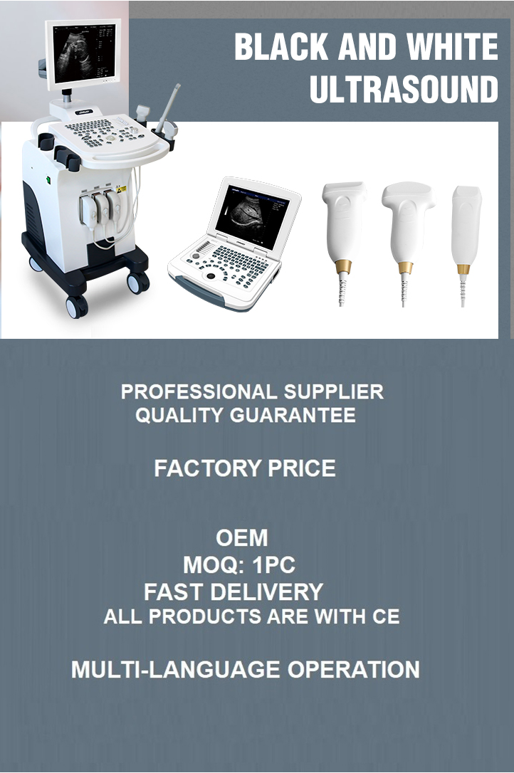 Portable Diagnostic Ultrasound Scanner