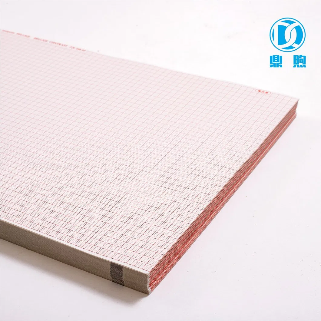 ECG Chart Paper Display 4