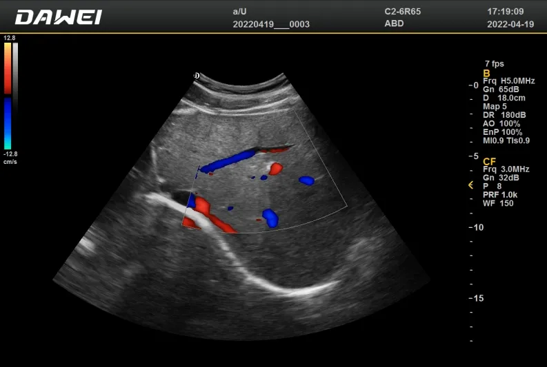Clinical Image 6