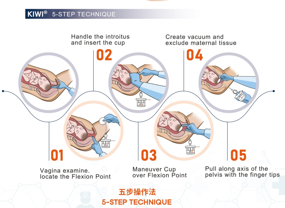 Wholesale Obstetric Suction Cup for Obstetrics and Gynecology Vacuum Delivery System