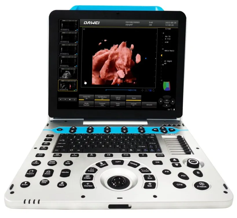 Portable Ultrasound Display